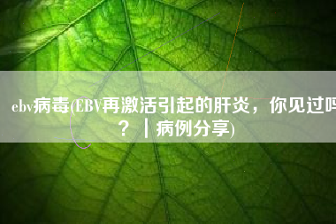 ebv病毒(EBV再激活引起的肝炎，你见过吗？｜病例分享)