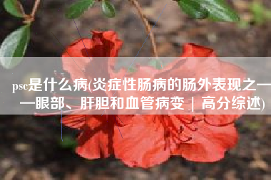 psc是什么病(炎症性肠病的肠外表现之——眼部、肝胆和血管病变 | 高分综述)