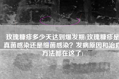 玫瑰糠疹多少天达到爆发期(玫瑰糠疹是真菌感染还是细菌感染？发病原因和治疗方法都在这了)