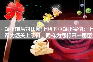 矫正前后对比图(上睑下垂矫正实例：上帝为您关上了门，同样为您打开一扇窗)