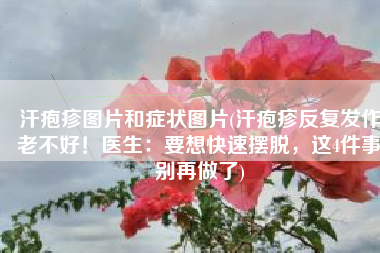 汗疱疹图片和症状图片(汗疱疹反复发作老不好！医生：要想快速摆脱，这4件事别再做了)