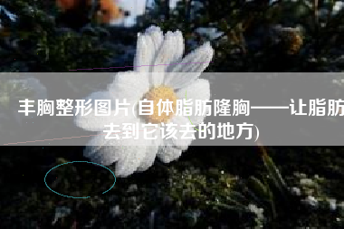 丰胸整形图片(自体脂肪隆胸——让脂肪去到它该去的地方)